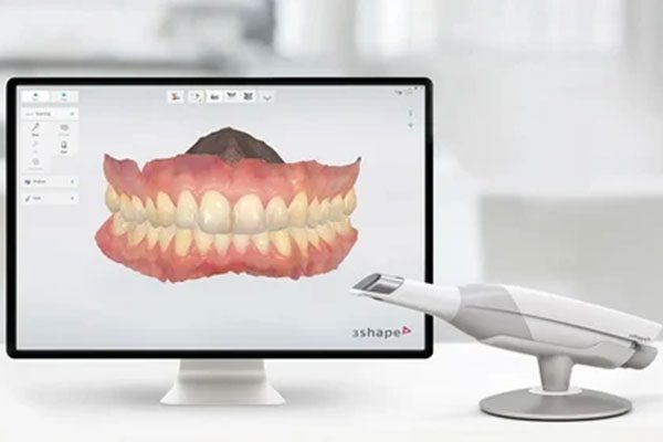 Intra Oral Scanner