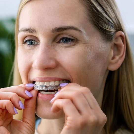 Invisalign near me