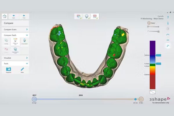 Trios Patient Monitoring Software